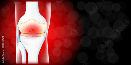 Knee joint pain