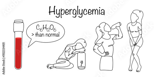 Hyperglycemia