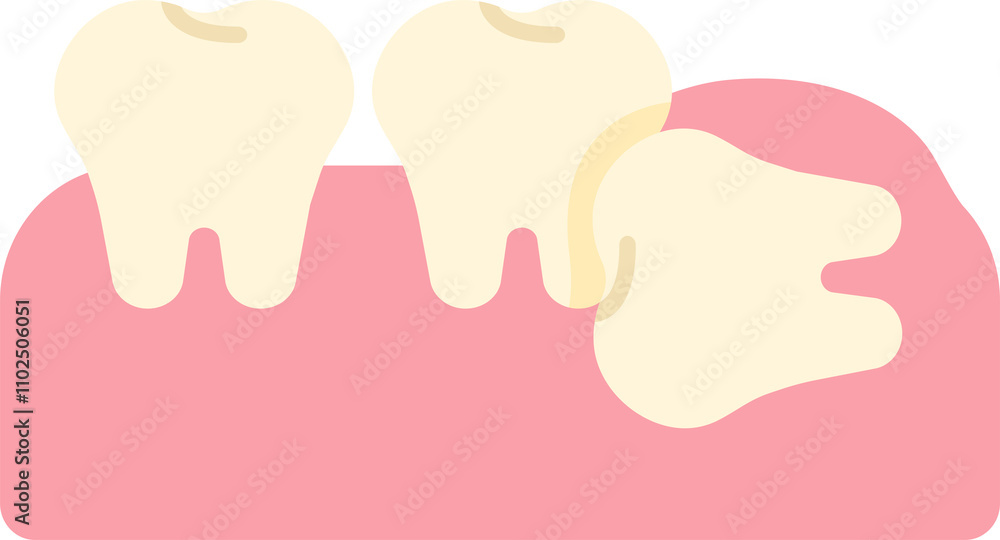 wisdom tooth removal remove discomfort pain oral dental care health