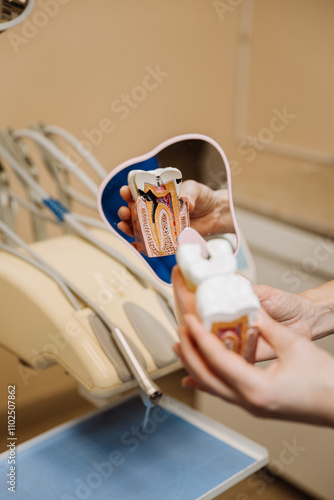 Tooth model reflection in a dental mirror highlighting oral anatomy and cavity for patient education photo