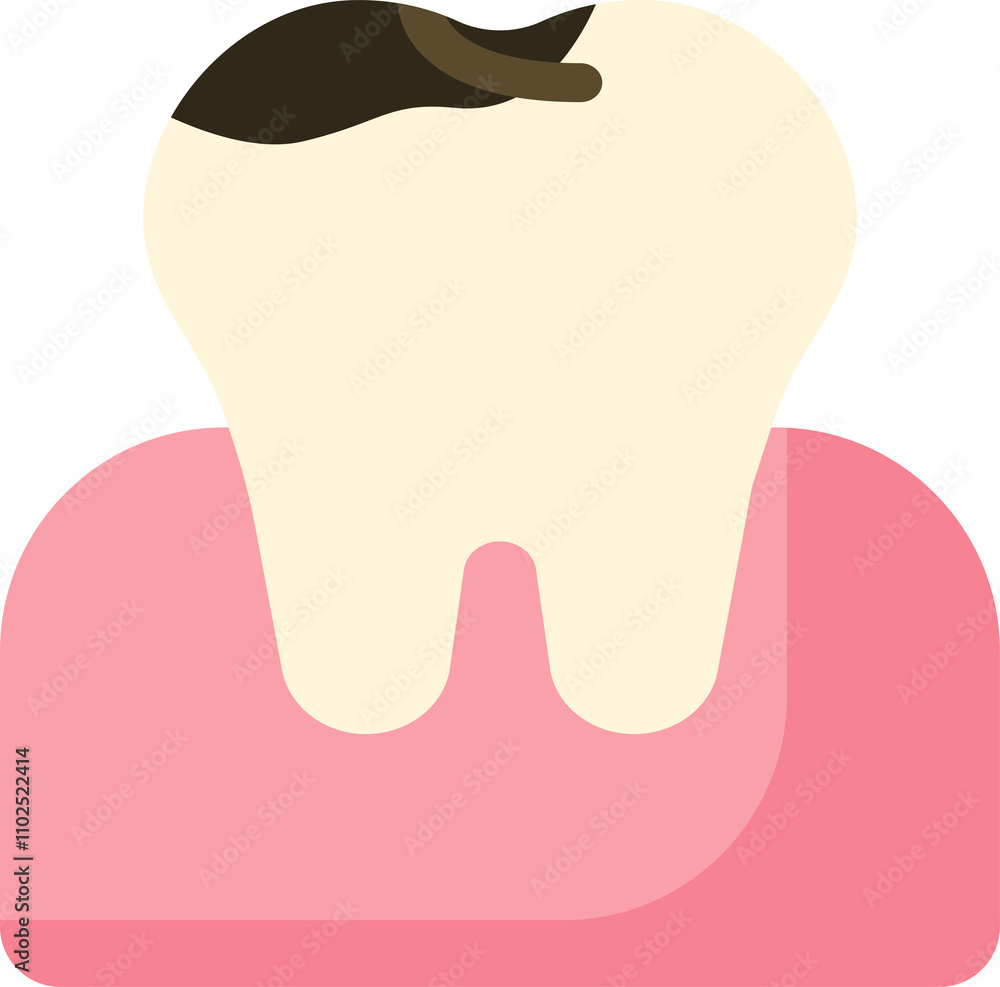 tooth cavity caries carious tooth cavity treatment root canal treatment tooth cavity caries carious tooth cavity treatment root canal treatment
