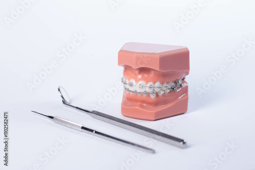 Orthodontic tools, brace, bracket system, tooth