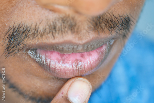 Close-Up Of Man's Chapped Lips and Facial Hair Detail