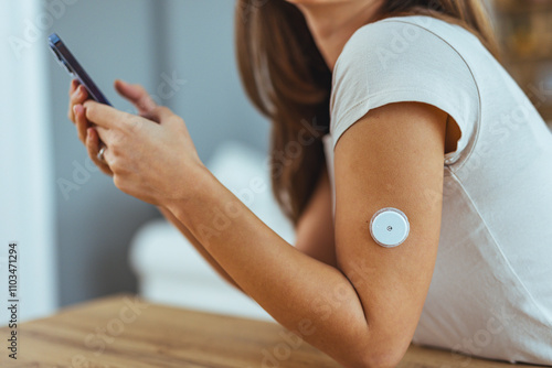 Woman Using Smartphone with Glucose Monitor on Arm