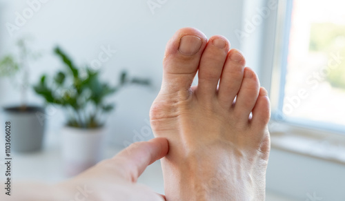 Adult foot with a bump, leg deformation problem, leg and foot health concept