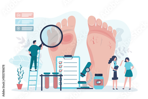 Podology, feet disease, fungal infection. Group of doctors exam patient, treatment of foot and nail psoriasis. Podiatrist analyzes psoriatic feet. Inflammation of the skin.