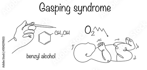 Gasping syndrome