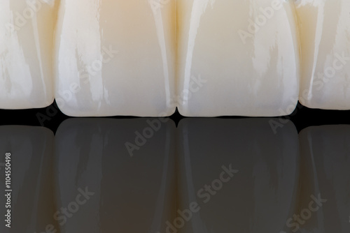 High-quality naturally dental single crowns made of zirconia and stained like old man teeth. photo