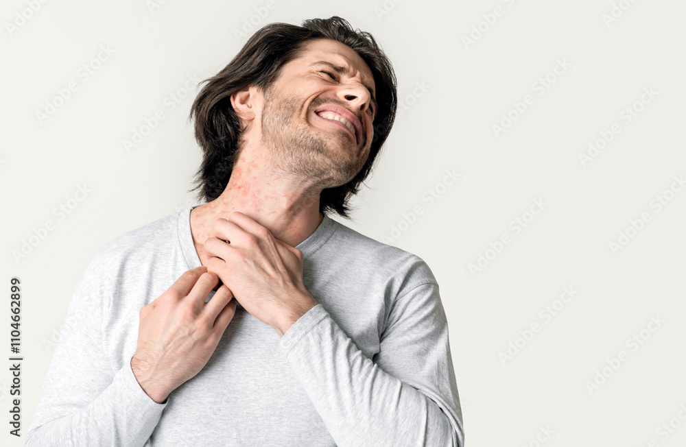 Eczema concept. Man suffers from skin irritation isolated on gray background Eczema concept. Man suffers from skin irritation isolated on gray background