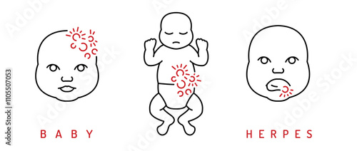 Minimalistic baby herpes icons set. Neonatalherpes awareness medical signs