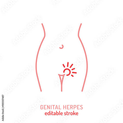 Genital herpes linear icon. Editable vector illustration