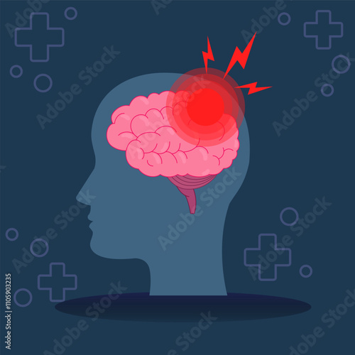 Illustration of Brain with Pain Symbol Highlighting Headache or Migraine