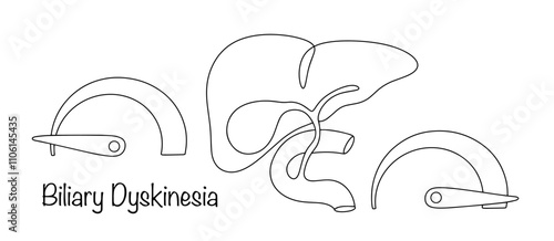 Biliary Dyskinesia