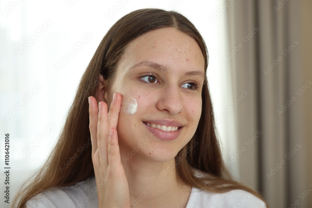 Teenage girl applying cream onto face at home. Acne treatment Teenage girl applying cream onto face at home. Acne treatment