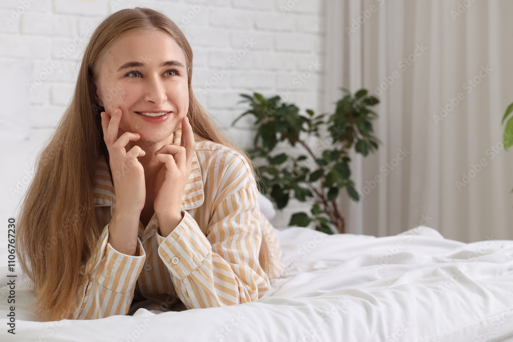 Young woman with acne problem and pimple patches lying in bedroom Young woman with acne problem and pimple patches lying in bedroom