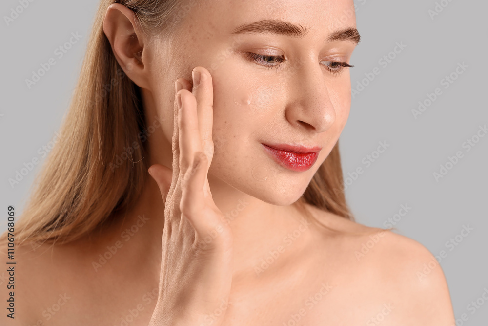 Young woman with acne problem and applied pimple patches on light background, closeup Young woman with acne problem and applied pimple patches on light background, closeup
