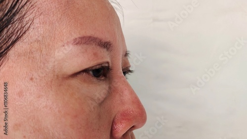 Photos close up the flabbiness and ptosis beside the eyelid, dark spots and blemish, scar and freckles, dullness and dry skin on the face of the woman, health care and beauty concept