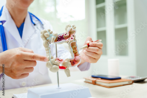 Photos A male doctor wearing glasses sits at a desk, explaining an intestinal model, di