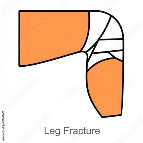 Leg Fracture