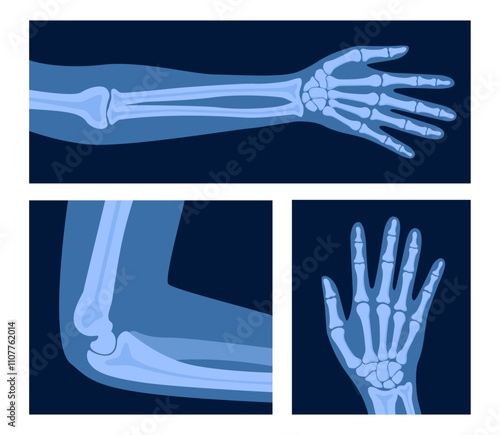 XRayBones-14.eps