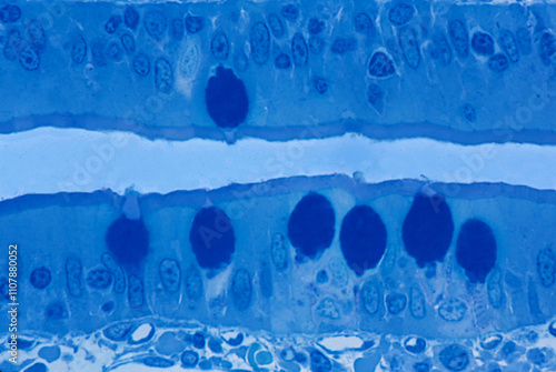 Quadro su tela Small intestine. Epithelium