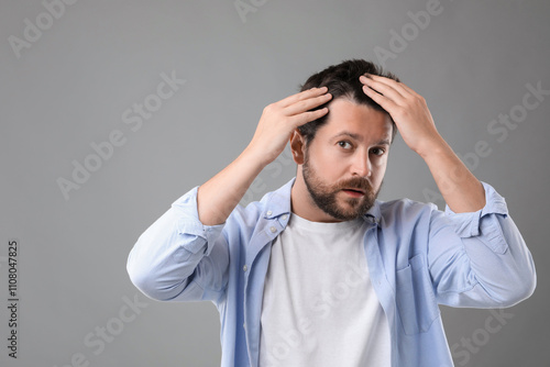 Man with hair loss problem on gray background, space for text photo