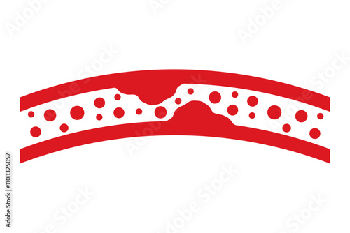 High blood cholesterol colorful icon with a arteriosclerosis risk. Clogged artery. Concept of high cholesterol and unhealthy lifestyle, fast food. thrombosis microvascular disease. Vector illustration