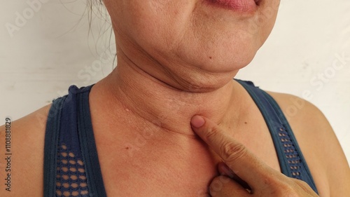 close up the flabbiness adipose sagging skin, wattle and cellulite under the neck, large and layer, Flabby skin and creases under the chin of the woman, health care and beauty concept.