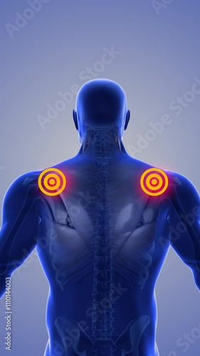 Shoulder discomfort that trigger pain