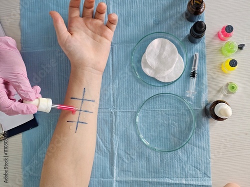 Obraz na płótnie Skin allergy testing process in a dermatology clinic with description of allergens
