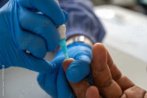 Photos Medical professional performing blood sampling with a lancet on a patient's finger, wearing blue gloves for hygiene