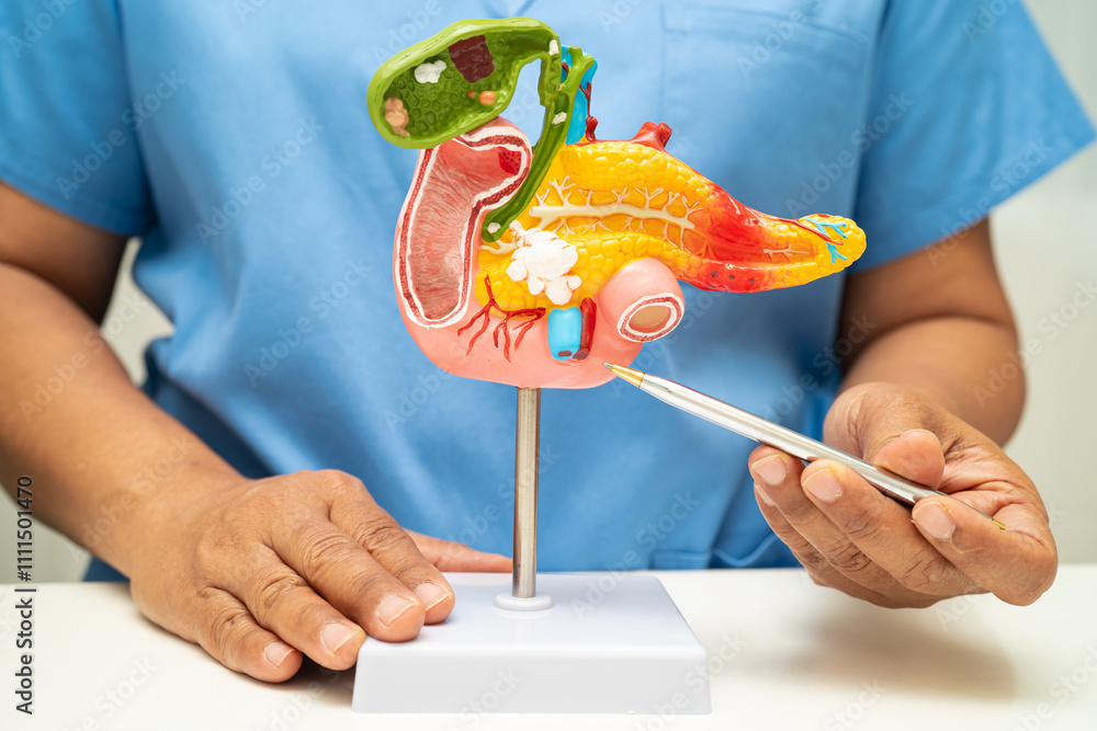 Φωτογραφία Pancreatitis, pancreatic cancer, Asian doctor with pancreas, gallbladder and bile duct human anatomy model at hospital