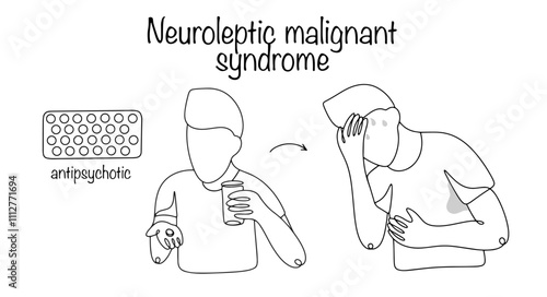 Neuroleptic malignant syndrome