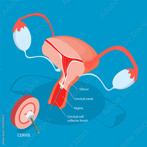 3D Isometric Flat Vector Illustration of Pap Test, Process Of Conducting A Pap Testing To Detect Abnormal Cells In The Cervix