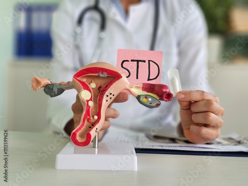 Model of female reproductive system and suppository medical tablet std. Uterus suppository