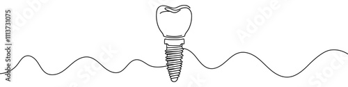 One continuous line illustration of dental implant, isolated on white background. Line art of dental implant