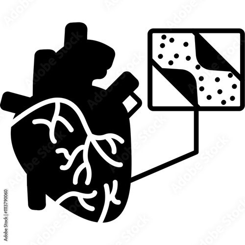 Coronary Artery Bypass Graft Icon