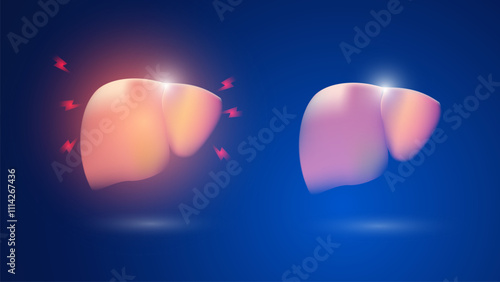 Vector illustration Human liver anatomy on blue background