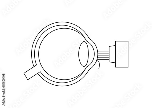LASIK eye surgery