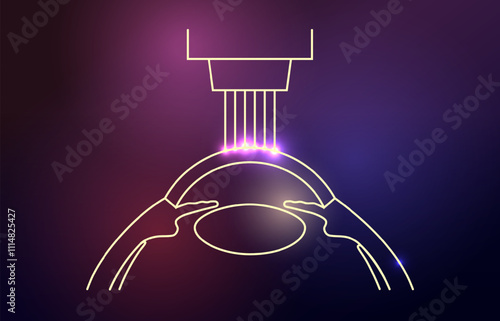 LASIK eye surgery