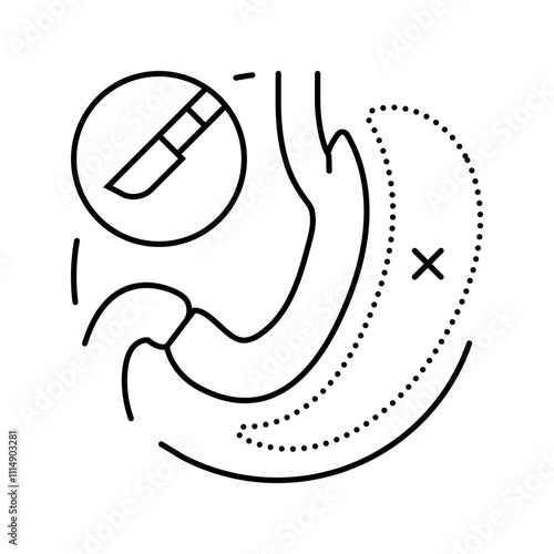gastrectomy surgery doctor line icon vector. gastrectomy surgery doctor sign. isolated contour symbol black illustration
