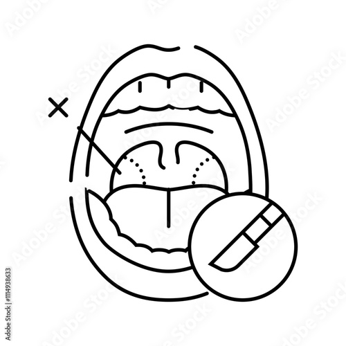 tonsillectomy surgery line icon vector. tonsillectomy surgery sign. isolated contour symbol black illustration