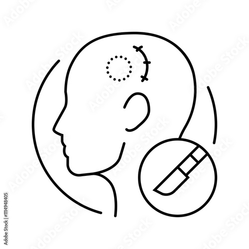 craniotomy surgery line icon vector. craniotomy surgery sign. isolated contour symbol black illustration