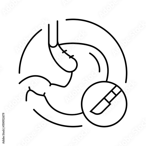 nissen fundoplication surgery line icon vector. nissen fundoplication surgery sign. isolated contour symbol black illustration