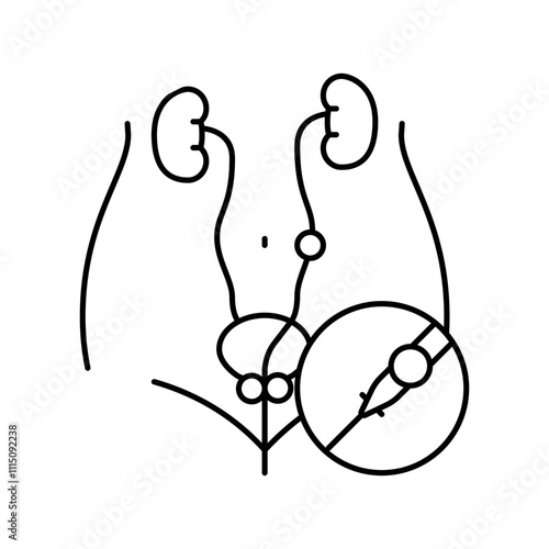 ureteroscopy urology line icon vector. ureteroscopy urology sign. isolated contour symbol black illustration