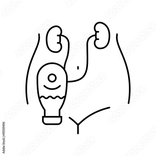 hydronephrosis urology line icon vector. hydronephrosis urology sign. isolated contour symbol black illustration