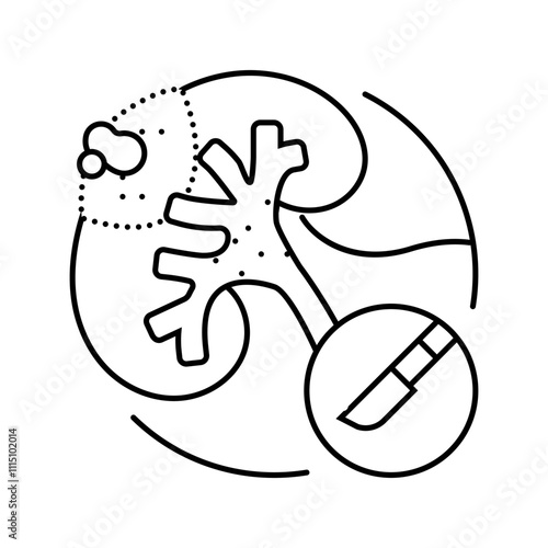 urostomy urology line icon vector. urostomy urology sign. isolated contour symbol black illustration