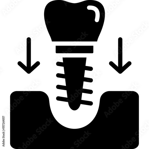 Dental Implant Icon