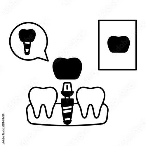 Replacing one Missing Teeth using Dental Implant Concept, permanent fixed dentures replacement vector outline design, Odontology symbol, manual dexteritysign, Dentist tools stock illustration