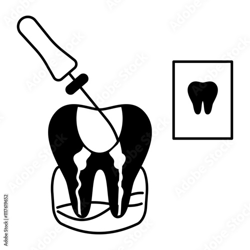 Endodontic therapy Root canal treatment Concept, dental examination with Probe and Repair cavities vector outline design, Odontology symbol, manual dexteritysign, Dentist tools stock illustration